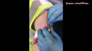 Solid proof that at least some of the vaxxed were injected with what is likely an RFID chip- 7-26-21