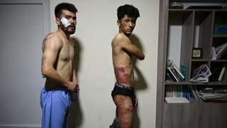 Taliban beat journalists for covering Afghanistan protests