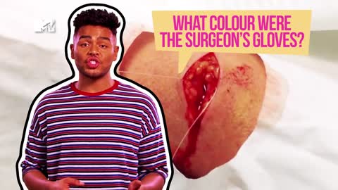 Open Wide As MASSIVE Gross Tonsil Stones Get Yanked Out | What The Yuck?! Ep #9