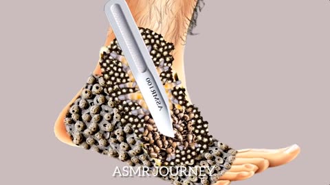 Asmr athlete' foot full with fungs during playing #asmr #2danimation