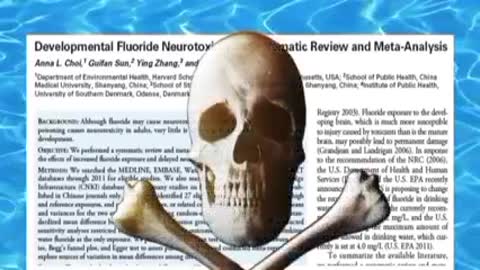 CAUSES OF PINEAL GLAND CALCIFICATION (PART 1)