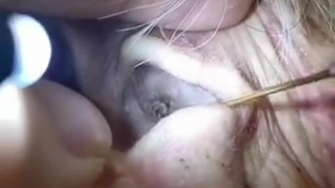 gigantic ear wax removal #48