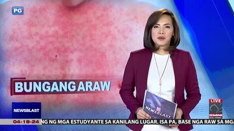 Health expert, nagpaalala para iwas bungang araw ngayong tag-init ang mga kabataan