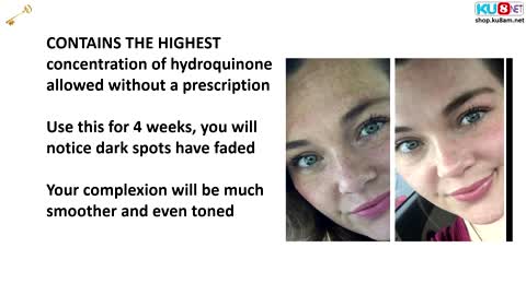 2% Hydroquinone Dark Spot & Melasma Corrector- Admire my skin | Dark Spots