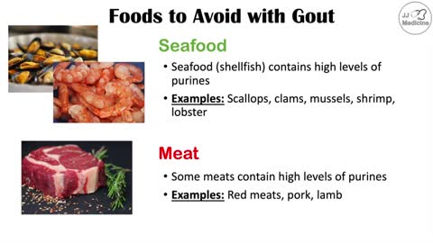 Best - Worst Foods to Eat with Gout Reduce Risk of Gout Attacks and Hyperuricemia