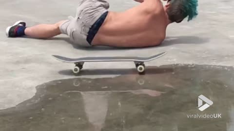 Skateboard to the face