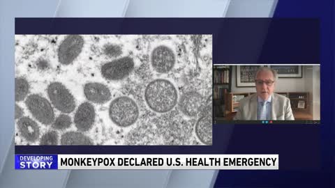 Dr. Murphy declares monkeypox a a public health emergency