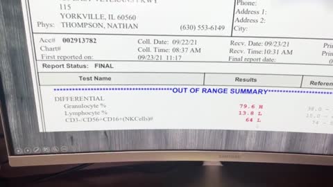 Immune system before and after jab