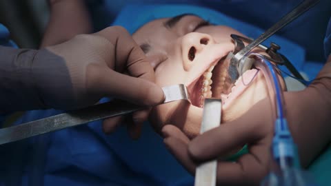 Dentist Doing Surgery in a Patient's Mouth 👄