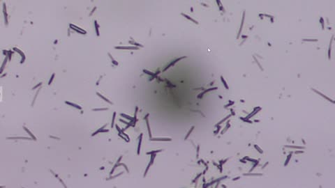 Spike Protein & A Graphene Cluster Bomb Center in the Live Blood Revealed Under pHase Contrast Microscopy