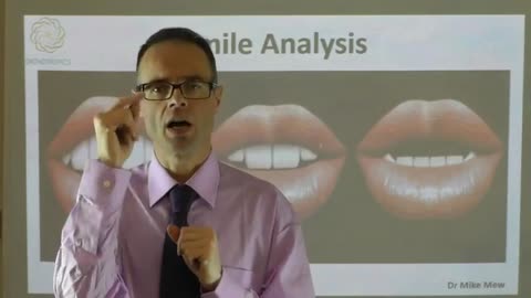 Importance of Smile Analysis in Facial Beauty in Restorative Dentistry & Orthodontics by Dr Mike Mew