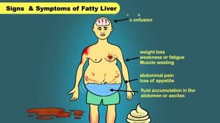 Fatty Liver Treatment | Fatty Liver Diet