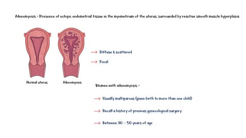 Adenomyosis _- Definition, Causes, Risk Factors, Signs & Symptoms, Diagnosis & Treatment