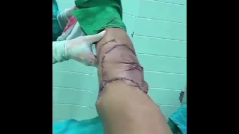 Herida de turista tras ataque de tiburón
