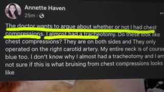 THAT WAS ONE WILD BIRTHDAY PARTY, CLOTS BRUISED BOOBS A CUT ARTERY CHEST COMPRESSIONS, AN OPERATION