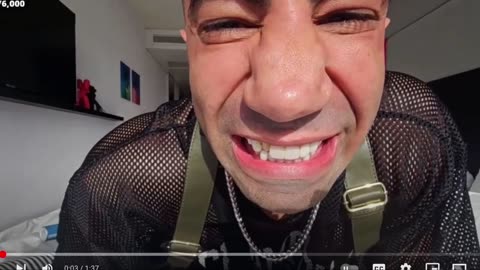 FOUSEY LOST HIS TOOTH BUT GETTING DIAMONDS SOON #kickstreaming