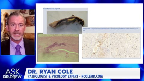 Dr. Ryan Cole on Vaccine Induced Blood Clots & Nattokinase