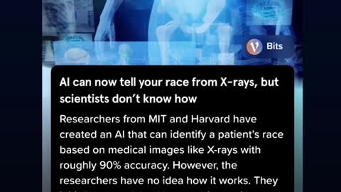 AI can now detect your race from an X-ray