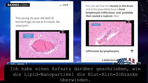 Autopsien-Es ist eine Biowaffe-Naomi Wolf