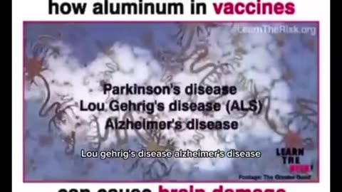 LEADING EXPERT EXPLAINS HOW ALUMINUM IN VACCINES 🧠💉☠ CAN CAUSE BRAIN DAMAGE