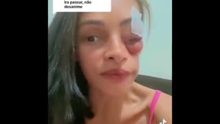 Vaccine Victim, Brazil