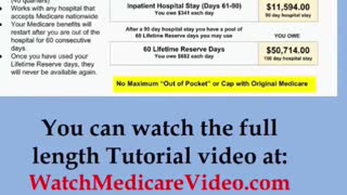 Part 15 - Medicare Tutorial - more information about Medicare Part A (Hospital)