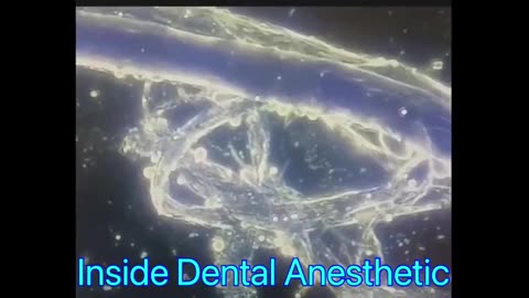 INSIDE DENTAL ANESTHETIC... ARE YOU GOING TO THE DENTIST ANYTIME SOON?