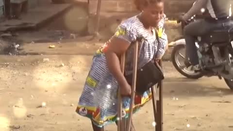 polio women with crutches