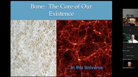 63. Bone Health - Dr. McCormick