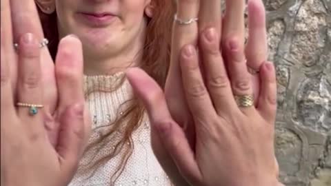 Largest hands on a living person (female) 🖐 Rumeysa Gelgi 🇹🇷