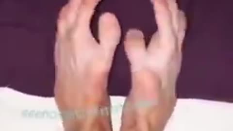 IF YOUR FRIEND TOOK OFF HIS SHOES AND HIS FEET LOOKED LIKE THIS...WHAT WOULD YOU SAY?