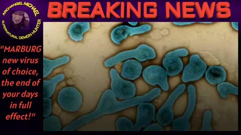 MARBURG a new deadly virus has emerged, BREAKING NEWS