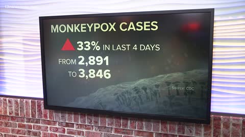 U.S. has most cases of Monkeypox across the globe