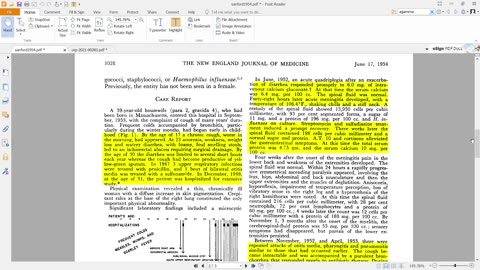 Virology 21: More Problems with Virus Isolation - Gamm Goblulins and Isolation