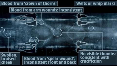 IS THE SHROUD OF TURIN REAL???