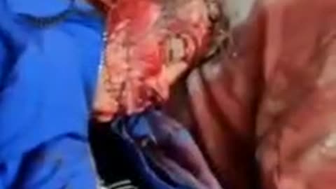 Ukrainian civilians killed (DRASTIC VIDEO)