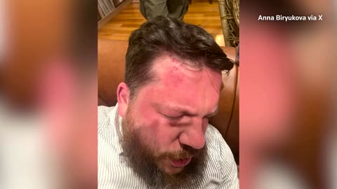 Kremlin critic Navalny's aide speaks after being attacked