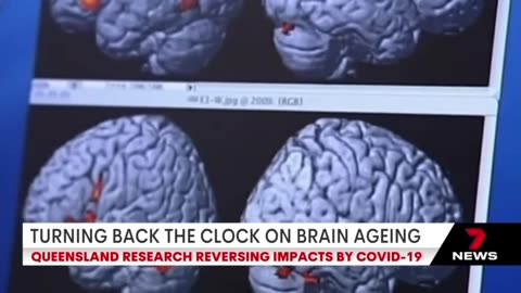 C-19 NOW CREATES ZOMBIE CELLS THAT SPEEDS UP THE AGING PROCESS AND DAMAGES THE BRAIN