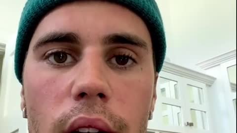 Justin Bieber reveals he has facial paralysis