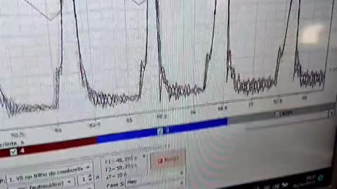 Diagnóstico avançado com o MTPRO