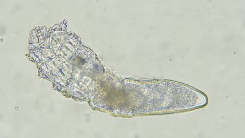 These Face Mites Really Grow on You Deep Look