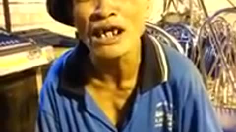 The man with the world's funniest teeth