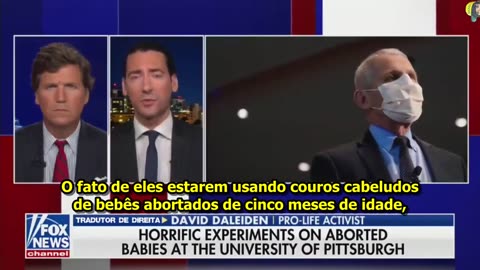 Dr. Anthony Fauci enxertou escalpos de bebês abortados em ratos de laboratório.