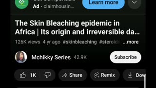 The Dangers of Skin Bleaching - This is Horrifying