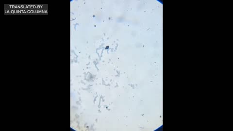 3-day light microscopic analysis of the dried drop of hepatitis B vaccine