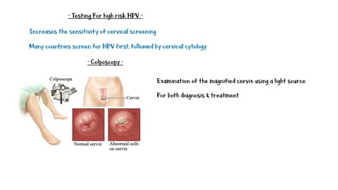 Cervical Cancer _- Causes, Risk Factors, Signs & Symptoms, Diagnosis & Screening And Treatment