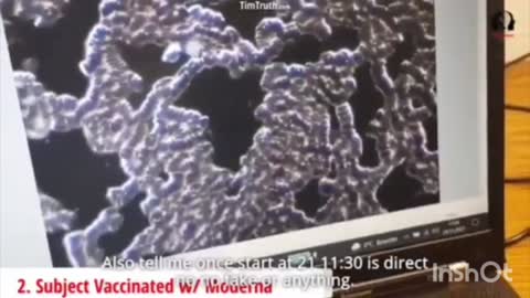 Covid-19 "Vaccine" - TESTED BLOOD 4 'JABBED' & 4 UN 'JABBED' Under A Microscope - please Share?