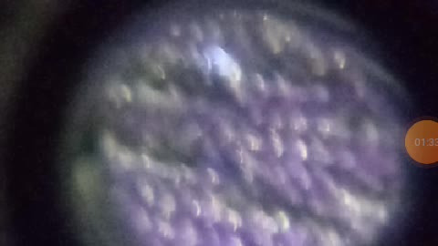 Ocular lens looking at nanoparticles