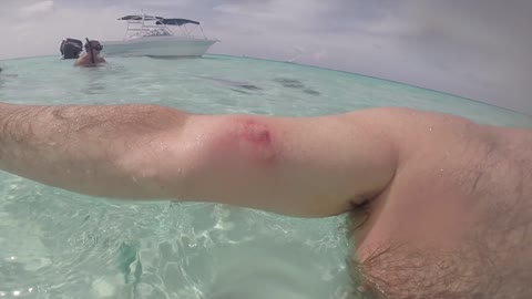 Guy gets bit by a stingray on Grand Cayman Island