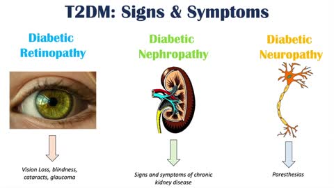 Type 2 Diabetes Signs - Symptoms -- Why They Occur- - Associated Conditions